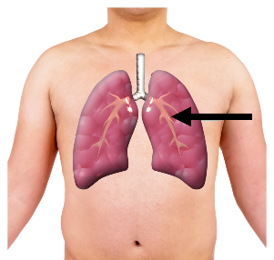Lungs