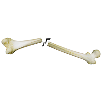 Injury